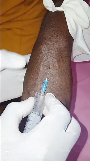 Intravenous Injection Step-by-Step #ivinsertion #ivinjection #doctor #nursing #ytshorts #trending