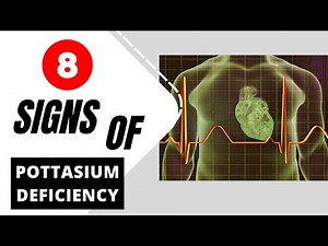 Potassium Deficiency : 8 Warning Signs That You Have Low Pottasium