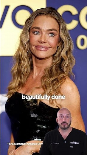 Denise Richards: Before & After👑