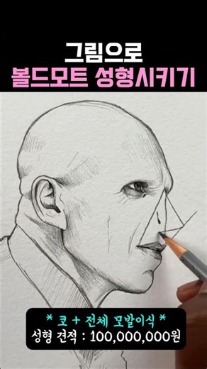 볼드모트 성형 견적 : 1억