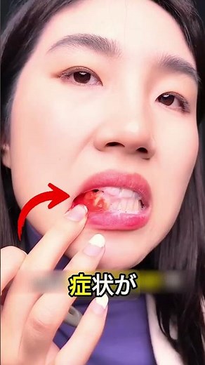 歯磨き中の「出血」を放置するとどうなる？😱🛑