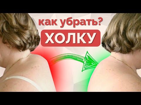 How to get rid of a dowager's hump? Exercises for the withers.