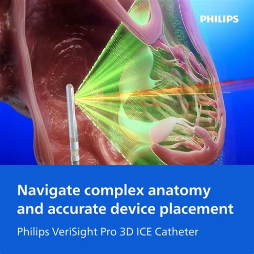 VeriSight Pro 3D ICE | Stephanie Frilow