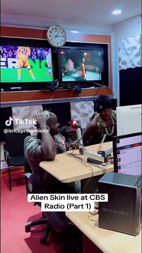 Alien Skin Live at CBS Radio - Unforgettable Performance