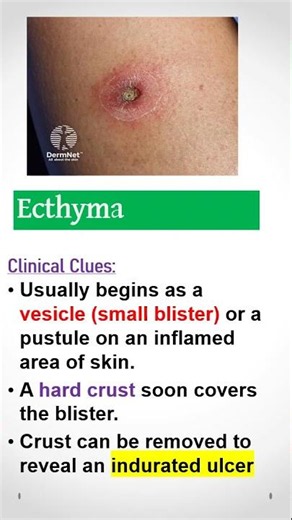 Dermatology Spot Diagnosis Quiz #53. Doctors, check your Clinical Skill