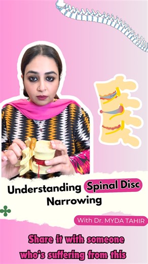 18K views · 171 reactions | When the discs between your vertebrae...