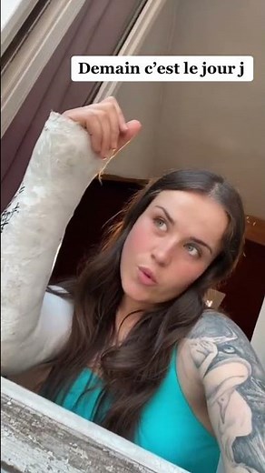 LONG ARM CAST WOMAN 😍💕💜