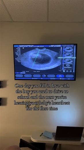 Hearing My Baby's Heartbeat for the First Time