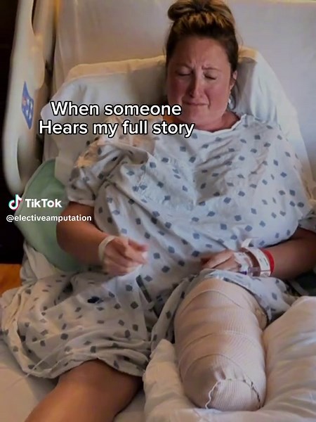 Understanding Elective Amputation: A Personal Journey