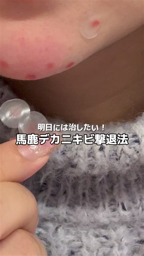 速攻でニキビ治したい時あるよね💦綾ちゃんも使ってたエレキリフトで撃退🕊️🤍めっちゃ汚れてた😂 #美顔器 #ブライト #エレキリフト #pr