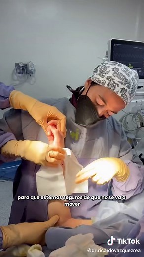 Cirugía de Muñeca Desplazada: Proceso y Cuidados Postoperatorios