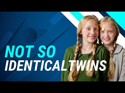 Why identical twins become different as they age