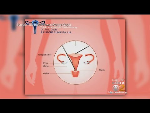 New Study Looks At Long-Term Effects Of Hysterectomies