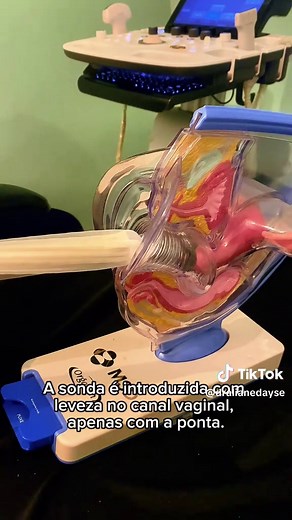 Exame Transvaginal: Passo a Passo para Saúde Ginecológica
