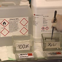 Video: Quantitative Mass Spectrometric Profiling of Cancer-cell Proteomes Derived From Liquid and Solid Tumors