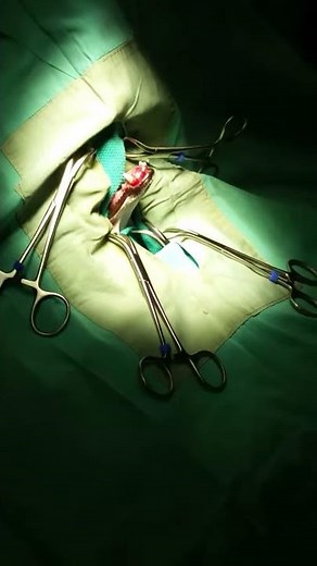 canine mandibulectomy part 1 crystal creek animal hospital