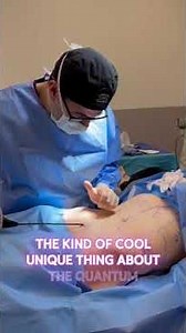Double the Power: Quantum RF + Morpheus8 Body Contouring with Dr. Franco
