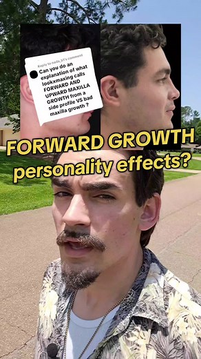 Forward Growth and Its Impact on Facial Features