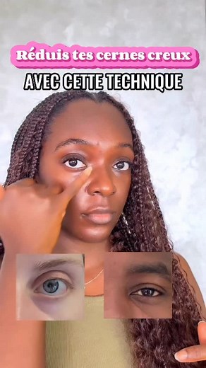 3.8K views · 318 reactions | Et si le creux sous tes yeux venait d’un...