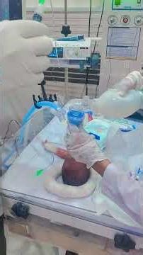 Surfactant replacement therapy for newborns, typically used to treat Respiratory Distress Syndrome