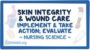 Video Case Study - Skin Integrity and Wound Care: Video, Causes, & Meaning | Osmosis