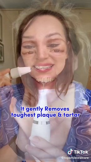 top-smile บน TikTok