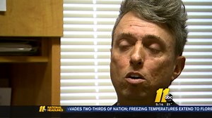 New discovery made about ALS could lead to a cure