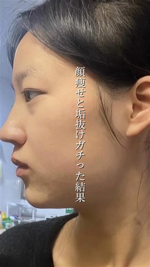 フェイスラインを引き締める秘訣