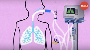 How do ventilators work?