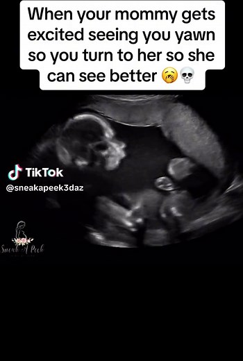 Baby is just getting into the Halloween spirit #ultrasound #2ndtrimester #pregnant #yawn #spooky #spookyseason #21weekspregnant #halloween #scary