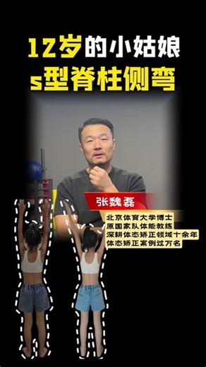 12岁孩子S型脊柱侧弯线上训练恢复效果! #脊柱侧弯#剃刀背矫正#脊柱侧弯怎么矫正#体态康复矫正#儿童脊柱侧弯矫正