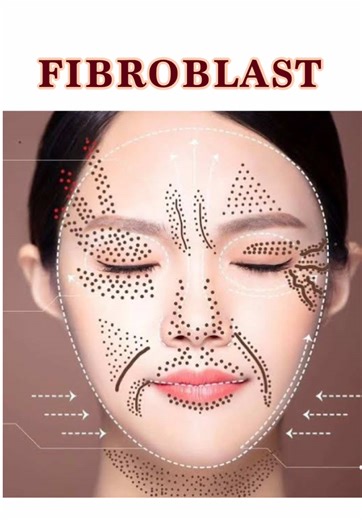 Fibroblast: Piel Joven Sin Flacidez ni Arrugas
