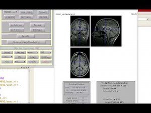 SPM Setting the Origin