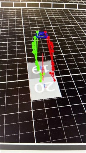 Assessing Balance of a Patient with Biofeedback in Virtual Reality: Will the Person Fall?