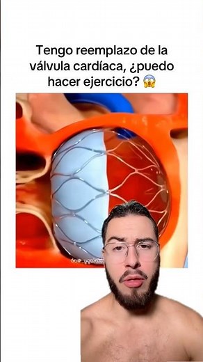 Así es un reemplazo de la válvula cardíaca 🫀