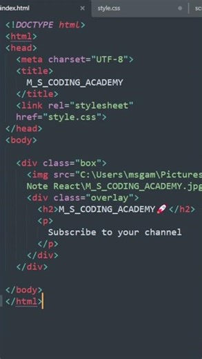 Animated Profile Card with Follow Button using HTML,CSS & JavaScript 🔥 #htmlcssjs #uidesign