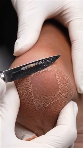 Foot Spa Clean-Up | Satisfying Exfoliation