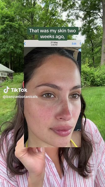 Banyan Botanicals on TikTok