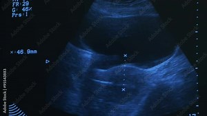 Fertility doctor with a microscope, a syringe and petri dish fertilization of eggs and research in reproduction clinics. Stock Video