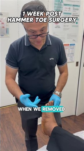 Goodbye hammertoe, hello recovery!