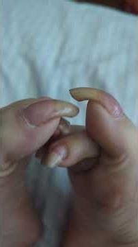 long toenails natural