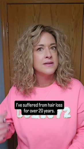 Denise Sheets on Instagram: "I have Androgenic Alopecia, which is also known as female pattern hairloss (similar to male pattern baldness, but it is more diffuse in women). I call it the long, slow death of our hair. Like so many, I waited way longer than I should have to try alternative hair and had to totally bypass toppers as my hairloss was so bad. I always say we come kicking and screaming to wigs because they have such a stigma to them. But why!?!?! Why do we have to suffer so long when wi