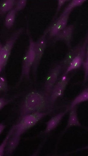 Daily CRISPR Updates on Instagram: "Researchers have developed a CRISPR screening technology that improves the understanding of childhood developmental disorders linked to cilia, or hair-like projections found on the surface of cells. The method combines genetic screening with automated microscopy and AI, allowing for detailed analysis of cilia and their functions. Their study identified numerous genes influencing ciliary formation and a crucial microprotein necessary for normal embryonic develo