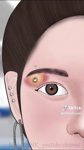 ASMR Infected eyebrow piercing removal#asmr #animation #satisfying #viraltiktok #viralvideo