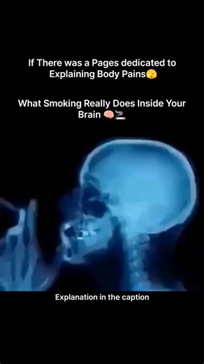 Explaining Biology on Instagram: "When you smoke, the effects inside your brain begin almost instantly. Nicotine travels through your bloodstream and reaches your brain in just a few seconds, triggering a rapid release of dopamine—the chemical that creates a temporary sense of pleasure and relaxation. But what looks like relief on the outside is actually stress on the inside. Your brain’s receptors become overstimulated, demanding more nicotine each time, slowly building dependence. The X-ray-st