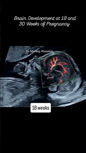 Fetus Brain Development in Pregnancy 🧠🧠