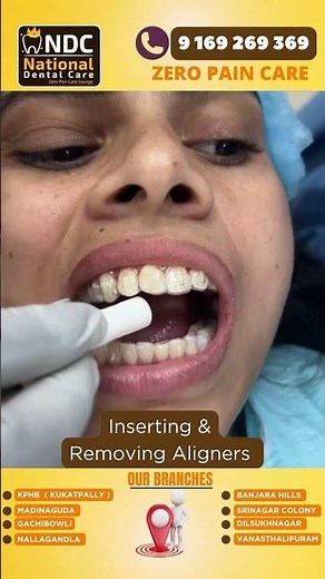 Aligner Tips - Inserting And Removing Aligners safely || Best Dental Hospital In Hyderabad || NDC
