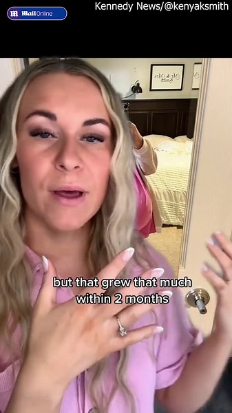 Woman reveals ovarian cyst that made her look pregnant could have crushed lungs