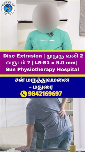 Disc Extrusion | முதுகு வலி 2 வருடம் ? | L5-S1 = 9.0 mm|ஆபரேஷனில் இருந்து தப்பித்தவர் | Sun Physio.