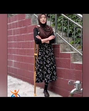 The beautiful amputee woman, a disability challenge, walks on one leg and a wooden crutch #oneleg